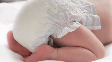 Everything There is to Know about Diaper Rash: Prevention, Home Remedies and Treatment